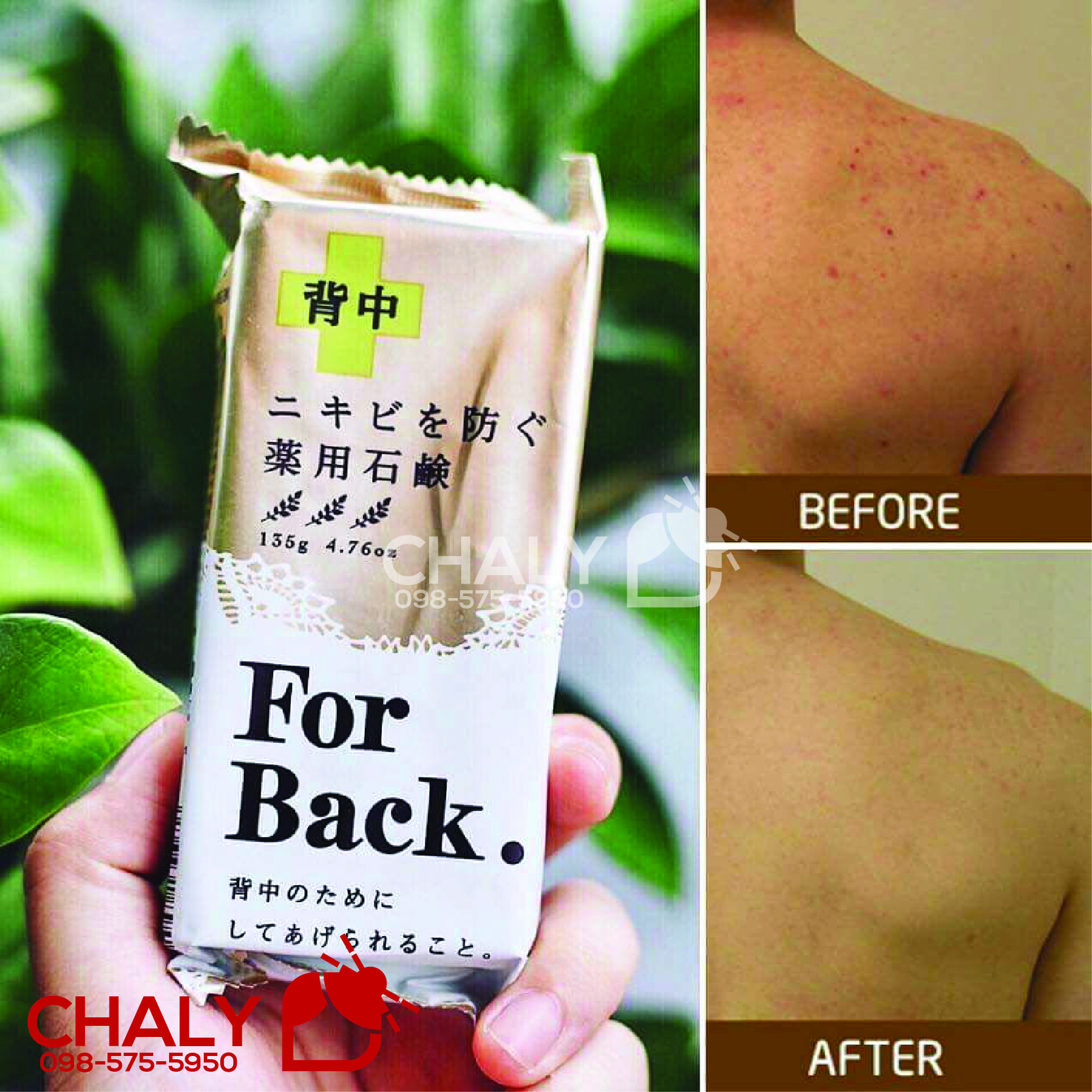 Xà phòng trị mụn lưng For Back là sản phẩm đặc trị mụn lưng số 1 Nhật Bản. Hiệu quả cao, bán siêu chạy