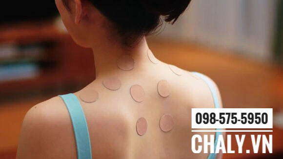 Miếng dán Roihi Tsuboko được dán trị đau vai lưng gáy cổ