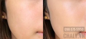 Muốn biết phấn nước nhật bản loại nào tốt thì các bạn soi thử da mình dùng phấn MSH time secret cushion xem sao đi