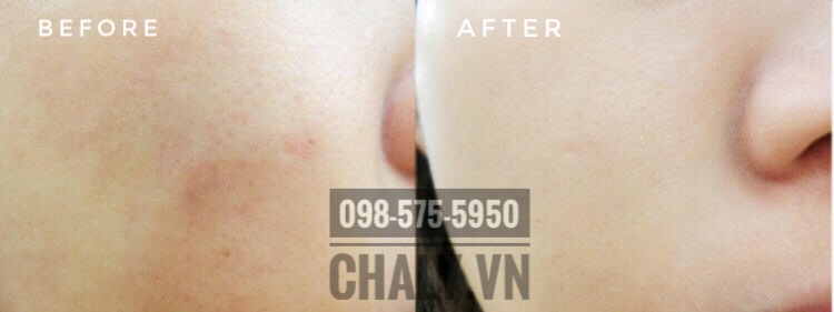 Kem lót trang điểm Chacott HD Enriching O2 Base nổi tiếng với khả năng che phủ khuyết điểm rất tốt