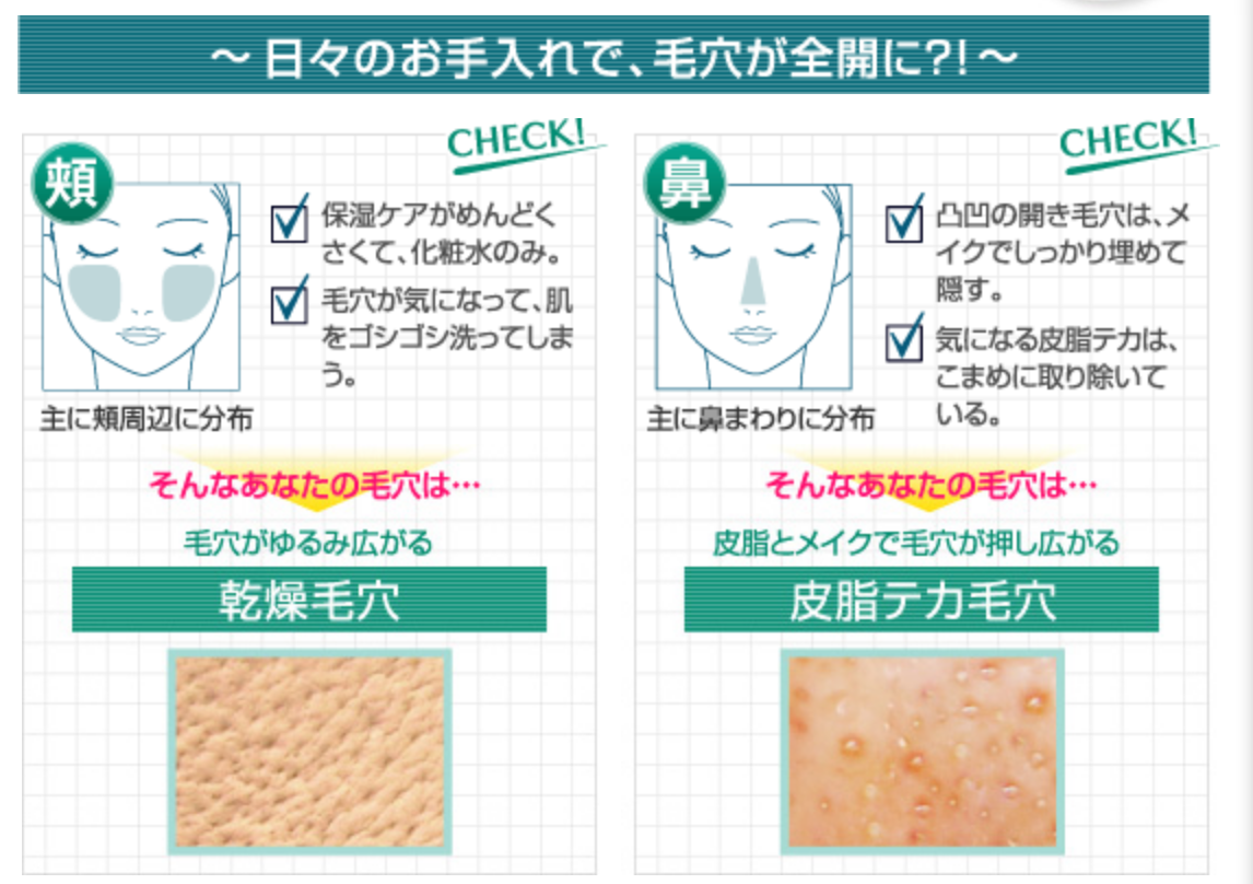 2 nguyên nhân chính gây tình trạng lỗ chân lông to. Kem dưỡng da gạo Keana của Nhật trị lỗ chân lông to ở tình huống bên trái là chủ yếu
