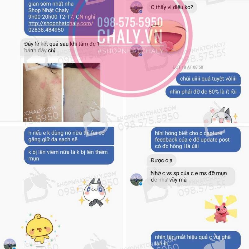 Xà phòng trị mụn lưng nhật bản review: khỏi tới 90% chỉ sau bánh đầu tiên, gửi ngay ảnh review cho shop