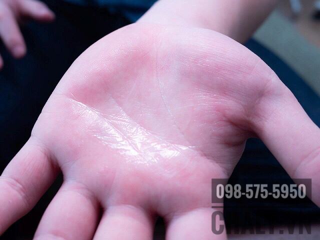 Sữa dưỡng ẩm Hada Labo khi thoa da sẽ như này nhé mọi người. Giống sữa chua. Thoa xong mịn và ráo thích lắm. Dùng ít thôi vừa tiết kiệm vừa đỡ dính da không cần thiết