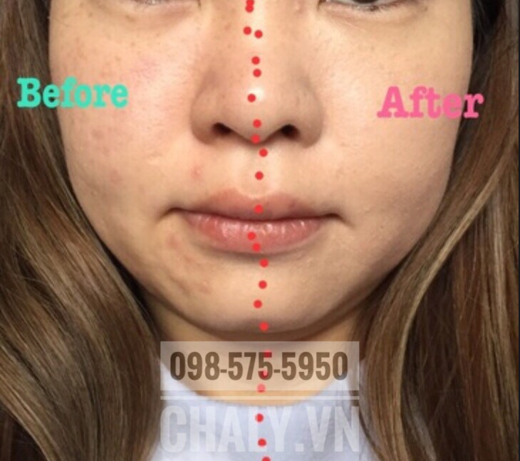 Phấn nước ion de cushion review bởi một bạn gái, cho thấy hiệu quả che phủ tốt nhưng vẫn tạo cảm giác mỏng nhẹ và rất tự nhiên của phấn nước ion de cushion Nhật Bản màu vàng