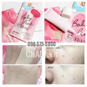 Có thể thấy chỉ 1 lớp mỏng manh kem nền Baby Pink là đầy đủ che phủ nang lông và những nếp domain authority, những mẩn nhọt dị ứng
