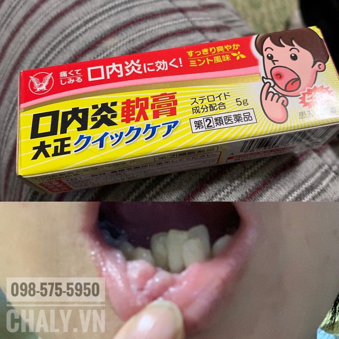 Nhà mình từ vợ chồng tới 2 con đều hay dùng kem trị nhiệt miệng taisho này. Giá rẻ mà hiệu quả. Vài hôm là đỡ