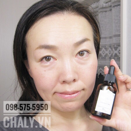 Để đạt hiệu quả rõ rệt thì nên dùng đủ lượng serum mà hãng Fracora khuyến cáo, tức là đo lượng serum theo vạch có sẵn trên ống spot