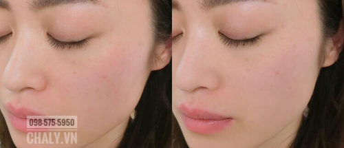 Em phấn Canmake che phủ đỉnh phết, phải nói là hơn đứt những em phấn đồng giá. Chả còn gì để chê