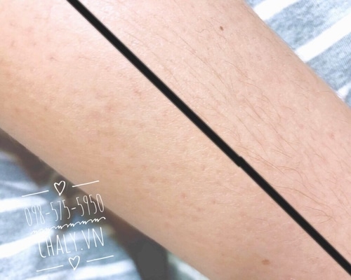 Chỉ cần 1 lần sử dụng là miếng dán tẩy lông Veet easy gelwax trả lại cho chị em ngay làn da trắng mướt và mịn màng