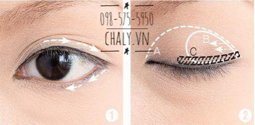 Chia mắt làm 3 phần A, B, C như hình vẽ