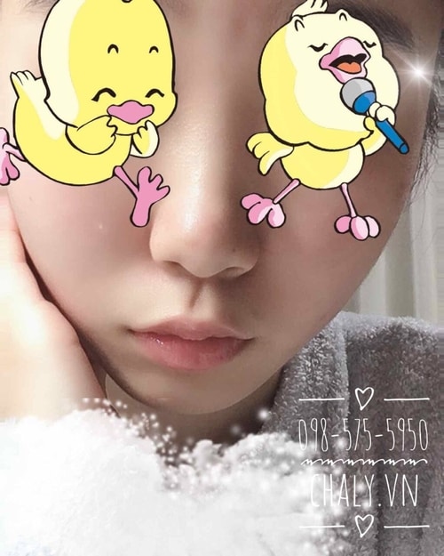 Ảnh review thực của bạn khách sử dụng sữa rửa mặt cám gạo Bijin Nuka Jyunmai của Nhật. Lỗ chân lông và mụn đầu đen hoàn toàn biến mất, da sáng mịn màng